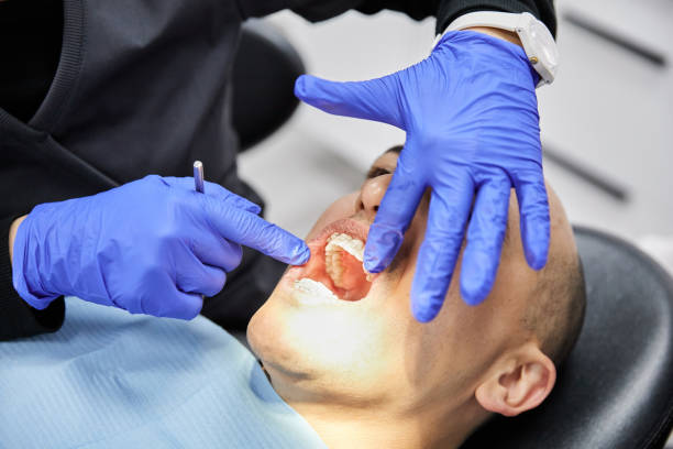 Best Walk-In Emergency Dental Services in Bellevue, IA